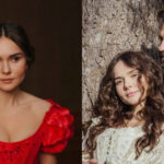 «Понад 60 опіків»: відомій акторці понівечили обличчя невинною процедурою