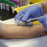 У 45 чоловіків є підозра на рак: Які результати акції Movember, що провели у Рівному